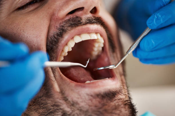 Best Pediatric Emergency Dentist in Silver Lake, FL